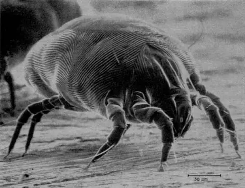 Dust mites are common unseen allergens in mattresses.