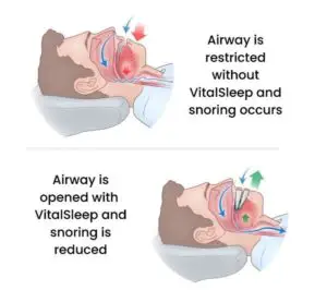 vitalsleep anti snoring mouthpiece