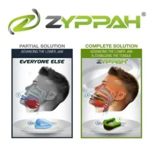 zyppah review 